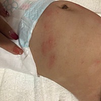 有没有宝妈知道这个是什么吗？经常有，但是会消下去，