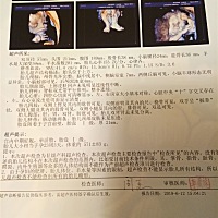 有谁能看出来，是乔治还是佩奇