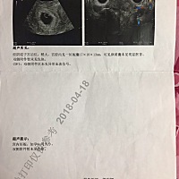 时间真快，上一年的怀孕到现在，女儿现在都已经6个多月了