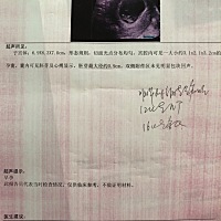 各位宝妈们，有哪位会看b超图和唐氏图呐，，这是我的孕期挨个检查的b超和数据，可惜我是头一胎，尽管很...