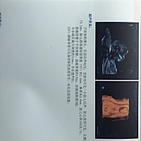 谁会看NT能不能看得出男女