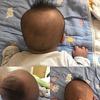 头型没睡好两个月怎么办