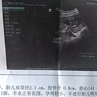 来看看男女，已经知道答案