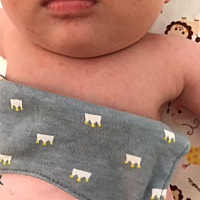 宝宝刚满一个月就长了奶藓（湿疹）脸颊、脖子上都是，这个可以用药吗？宝妈们都用过什么药