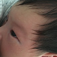 宝宝眼泪每天都是眼屎，什么原因呢