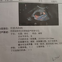 😂😂😃男宝女宝？😍😍