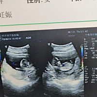 朋友们看得出男和女吗？