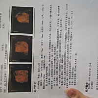 有人会看吗？是男孩女孩呀。