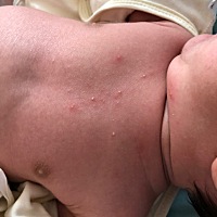 各位宝妈，能不能看出来胸前起的是啥？？