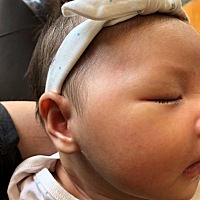 有没有宝妈知道宝宝脸上长得这是什么