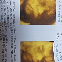 7.16预产期，有没有会看四维的看下男宝还是女宝呢，公公说肚子那么圆肯定是女宝
