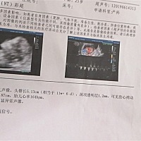 宝妈们，帮我看一下我的宝宝是乔治还是佩奇   十二周了，喜欢吃酸辣面  吃黄瓜和醋，不喜欢吃肉肉，...
