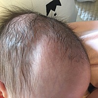 新生儿21天，发现宝宝右侧头部这样，请问有宝妈知道为什么吗？麻烦有经验的宝妈帮忙解答一下，谢谢🙏...