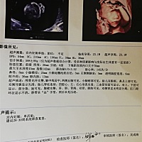 今天刚拍的四维，这能看出来男女么？😊有经验的宝妈过来讲一下。