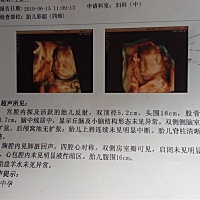 孕22周加六做的四维，请各位帮忙看看是男孩还是女孩。