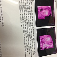 二胎中.. 来给看看是女宝男宝  虽是男女都喜欢 更希望是个女宝 凑成儿女双全！ 😄