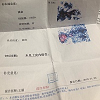 我说的是这个炎症重度，宫颈没事了。看完这个结果后，医生也没说要不要治疗。
