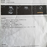 怎么感觉这个彩超有点不靠谱呢！
