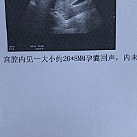 末次月经4.28。但是月经后第一次同房大概是在5.5之后。现在检查孕囊26mm*8mm 还没有胎芽 正常吗😭