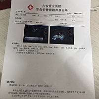 宝马们看看是女宝宝还是男宝宝，谢谢