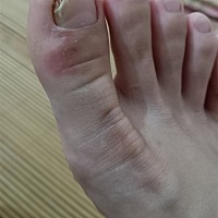 哺乳期能用止痒膏吗？脚好痒啊，又在喂奶怕担心，有知道的宝妈吗？