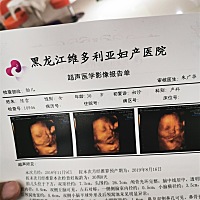 老公姓吴，怀女宝，名字还没想好呢，大家给点意见呗！