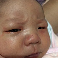 宝宝眼睛周围红红的，是怎么回事，好几天这样了，好心疼😔 有知道的宝妈吗？