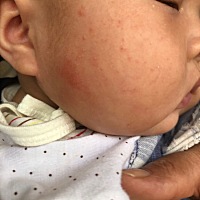 请问宝宝脸上这是啥啊