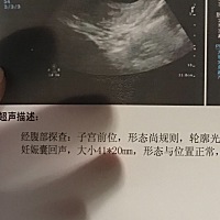 麻烦问问这个算什么形状的
