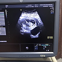 有会看男女的吗？好奇