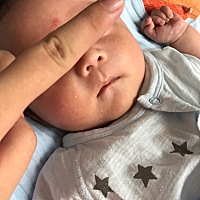 帮忙看看，有谁知道去除这些小白点的方法，