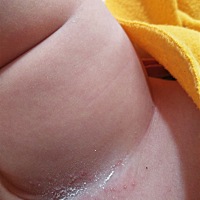 大家帮忙看看宝宝这是起湿疹吗？用涂抹什么好的快，我给摸了爽身粉，不知道管不管用，大家帮忙看看！谢...