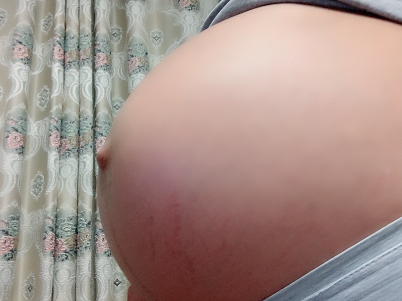 肚脐眼一直突出 肚子偏尖