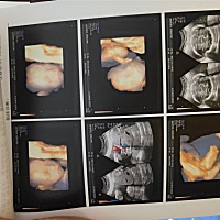 有没有会看的，帮我看下是男宝宝还是女宝宝，万分感谢😁😁