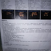 孕妈妈们，有会看数据分辨乔治和佩琪的吗？告知下呗，谢谢