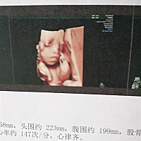 宝妈不容易啊！孕七个月这几天睡都睡不好，翻来翻去没有一个姿势是对的，还尿频，小家伙还越来越调...