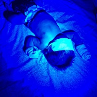 黄疸太高，自己在家照蓝光，不知道有没有效果