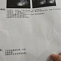 有医生吗？会看这个吗？ 会看这个吗？？