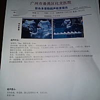 那位孕妈妈会看是男宝还是女宝  求解