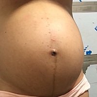 超快顺产无侧切无撕裂，19号凌晨12点18分起床上个厕所突然破水，破水之后马上开始规律宫缩7分钟一次...
