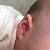 各位宝妈们  请问这是长了什么？