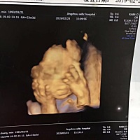 剖腹产男宝一枚，七斤一两，没想到挺清秀的，不丑嘿嘿。剖腹产其实也还好不疼。