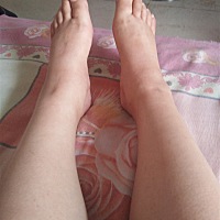 才三十一周，就肿成这样。😭怎么办？