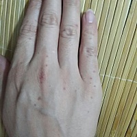 有孕妈出现这种情况的吗，手上长了好多红点，不疼不痒！也不是蚊虫叮咬的，昨晚睡一觉起来就有，一天了...