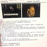 请大家帮忙看看四维是男孩女孩？ 现在孕24周去检查四维彩超的报告单子，请大家帮忙看看是男孩还是女孩，...