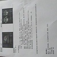 有会看单子的吗？帮忙看看🙏🙏🙏