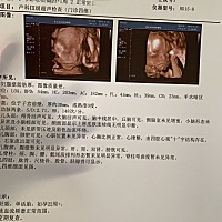 四维顺利通过，我的小宝宝到底长得像谁？是佩琪还是乔治呢😘😘😘