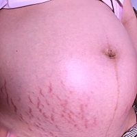 各种焦虑情绪，求明天发动，6月23号，小宝，你要出来哦