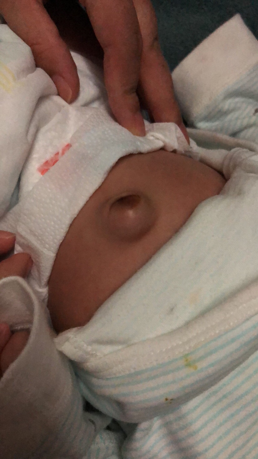 这是什么情况 按下去里面还有液体一样的东西 跟有水一样。