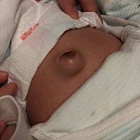 这是什么情况 按下去里面还有液体一样的东西 跟有水一样。